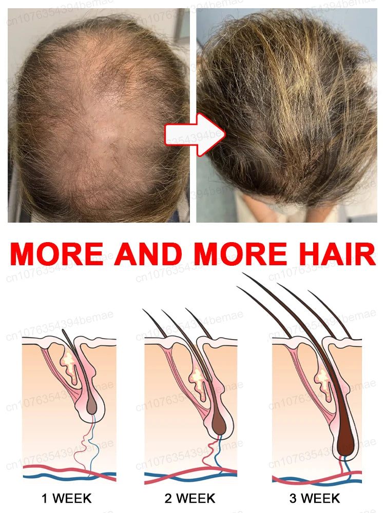 Rapid Hair Growth Essential Oil, Anti-Hair Loss Essential Oil, Repair Baldness, Prevent Baldness