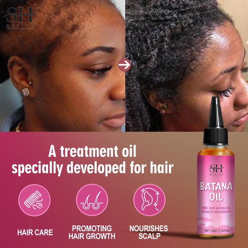 Natural 100% Pure Batana Oil For Hair Growth Batana Oil Butter Hair Mask From Honduras Hair Loss Treatment For Black Men & Women