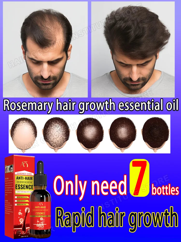 Rapid Hair Growth Essential Oil, Anti-Hair Loss Essential Oil, Repair Baldness, Prevent Baldness