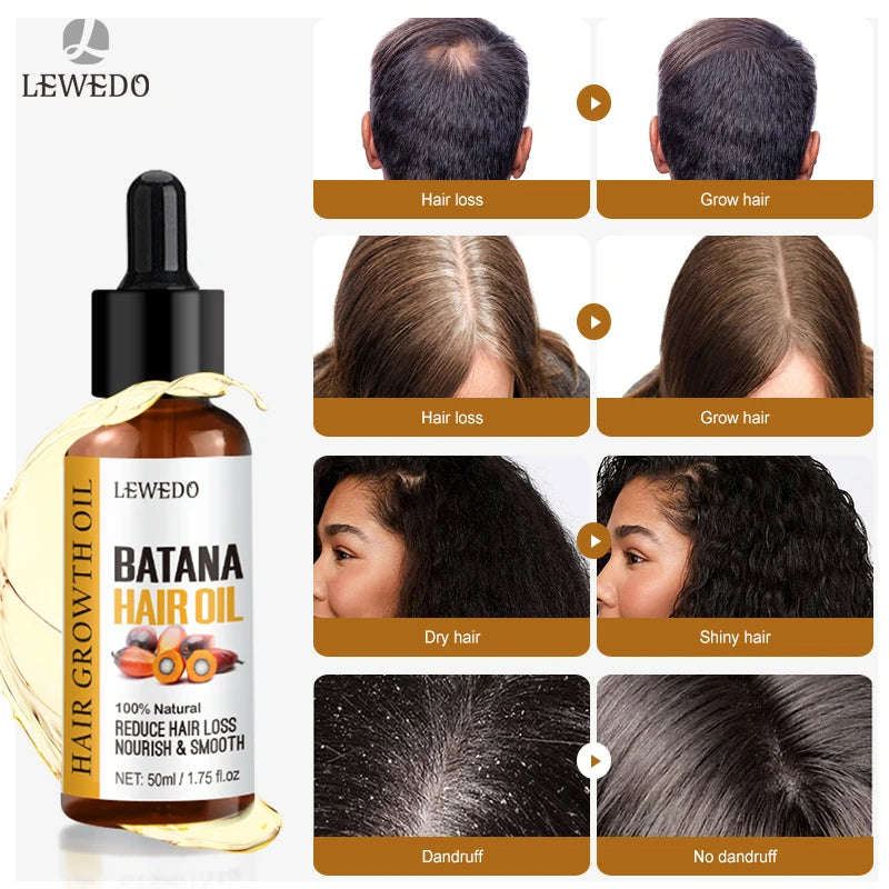 Natural 100% Pure Batana Oil For Hair Growth Batana Oil Butter Hair Mask From Honduras Hair Loss Treatment For Black Men & Women